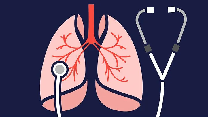 10 Cara Mengelola Bronkitis Kronis agar Tidak Semakin Parah